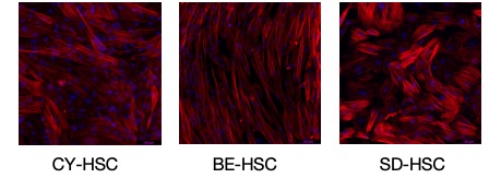 Launch of High-Quality Animal Hepatic Stellate Cells for Advanced Liver Disease Research and Drug Development(图1)