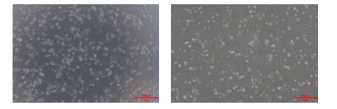 Kupffer Cell-Based Solution Launches Globally(图2)